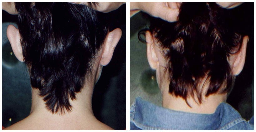 001-002-ear